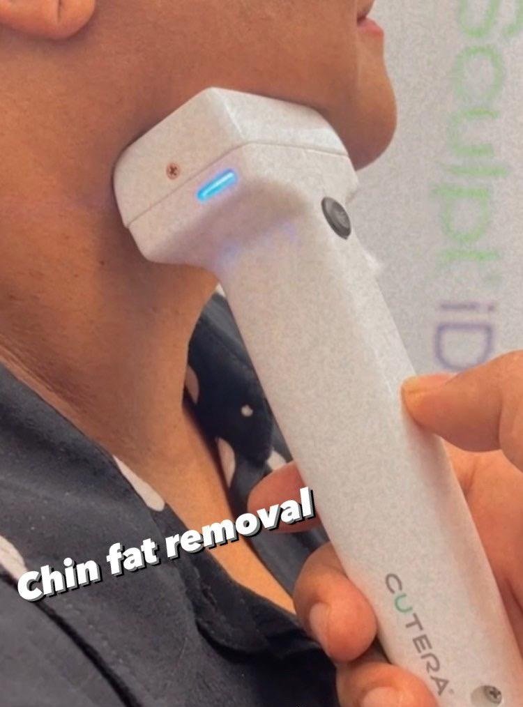 Jawline Contouring Miami